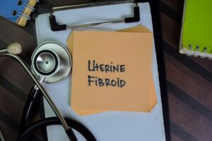 Uterine Fibroid Embolization Indiana
